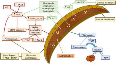 Middle Meningeal Artery Embolization in Chronic Subdural Hematoma: Implications of Pathophysiology in Trial Design